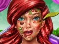 Игра Доктор за Кожа на Принцезата Русалка онлајн