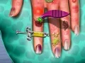 Игра Доктор на кожата на рацете онлајн